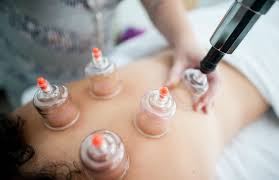 DIPLOMA IN CUPPING THERAPY